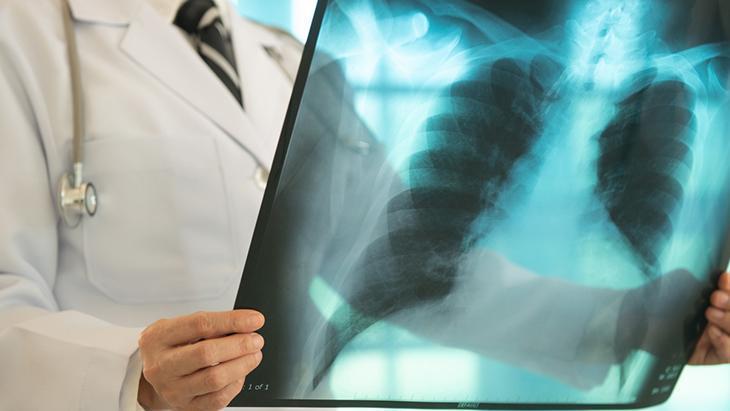 Uzun süren öksürüğe dikkat