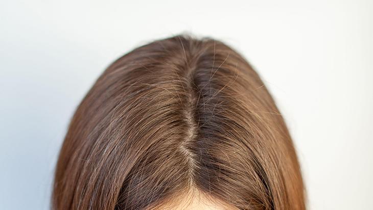 Doğal yağın da tehlikesi var Saç dibinden içeri sızıyor, hafif formül en iyisi