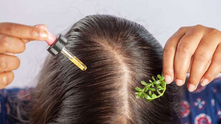 Doğal yağın da tehlikesi var Saç dibinden içeri sızıyor, hafif formül en iyisi