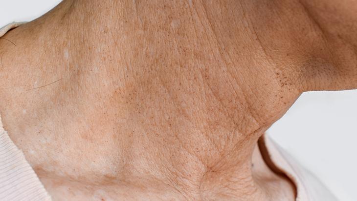 Boynunuzu 10 yaş gençleştirin Düzenli kullanımda fark yaratıyor, sırrı sıcak zeytinyağı