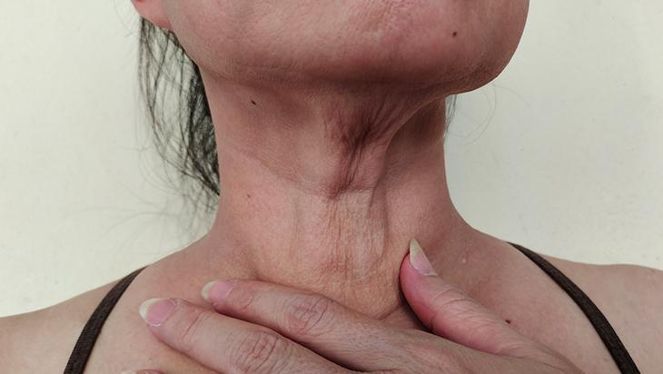 Boynunuzu 10 yaş gençleştirin Düzenli kullanımda fark yaratıyor, sırrı sıcak zeytinyağı