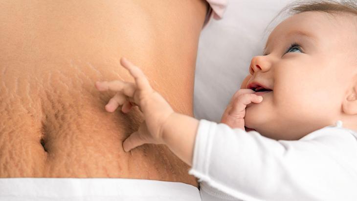 Bacaktaki, göbekteki çatlakları silgi gibi silen taktik 2 malzeme mucize yaratıyor