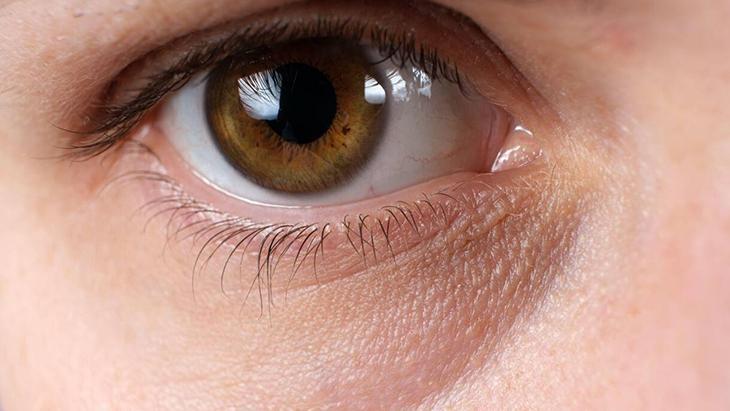 2- Çay poşetlerinden faydalanın