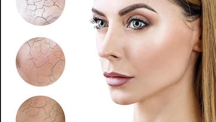 Toksinleri atarak sivilceleri önleyen en etkili taktik Bol bol için, şifa dağıtıyor