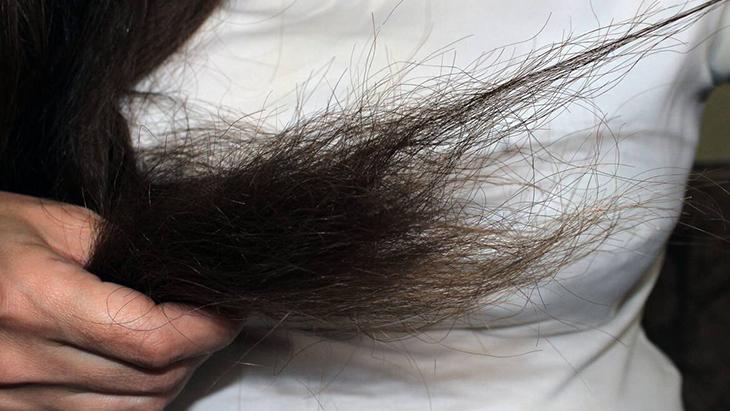 Neme mi yoksa proteine mi ihtiyacı var Hasarlı saçların kanıtı: Tel tel oluyor