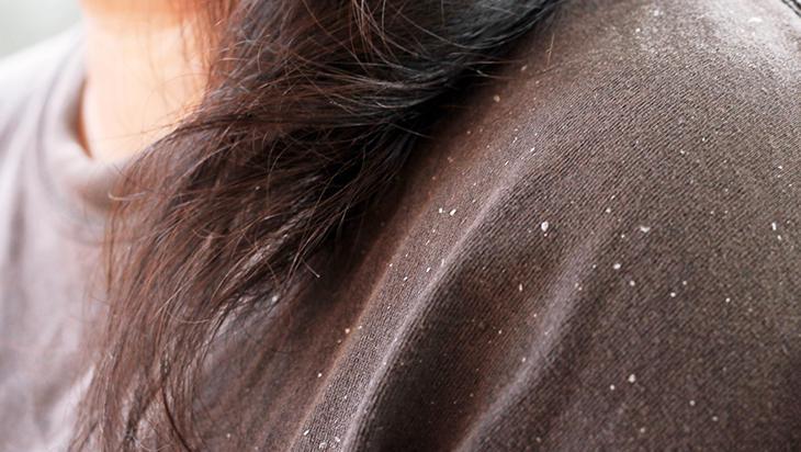 Pahalı bakımları aratmıyor, elma sirkesi varsa tamam Saçı durulamak yetiyor