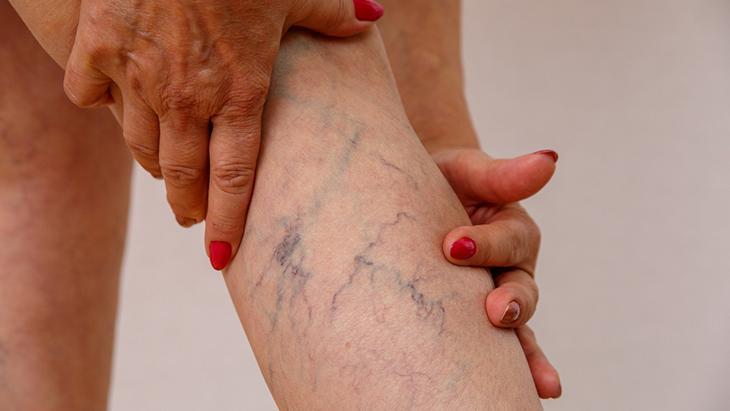 Şişlik, ağrı veya ani nefes darlığı