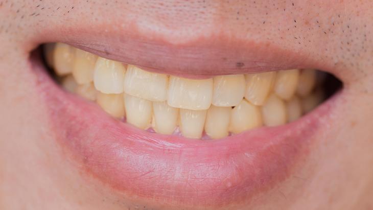 Kafein ağız kuruluğuna neden olarak sorunları artırabiliyor Kafein ağız kuruluğuna neden olarak sorunları artırabiliyor