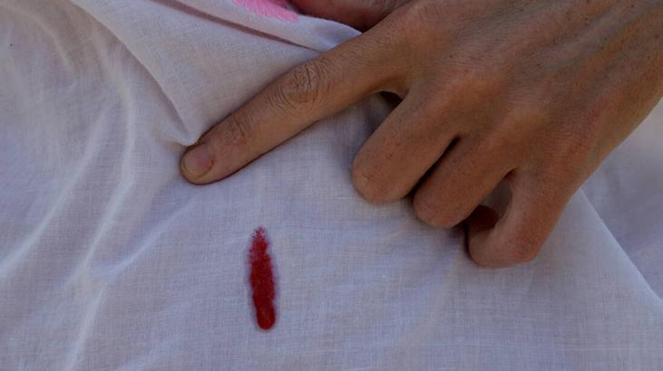 Çıkarmak isterken iyice derine itiyoruz Çaresi sıcak su değil, 5 dakikada leke uçacak
