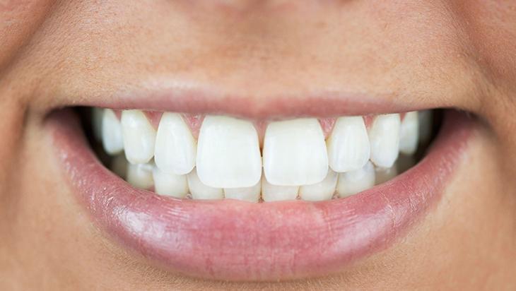 Dişi beyazlattığı sanılsa da gerçek başka Meğer yanlış yapmışız, içten içe bitiriyor