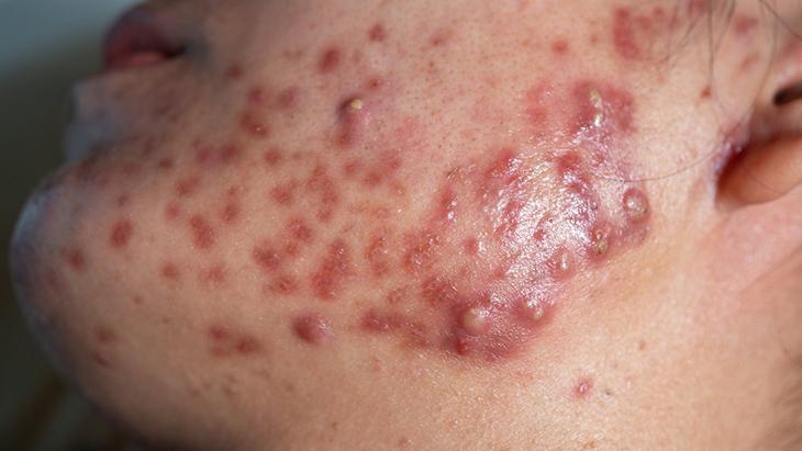 Sağlıklı bir beslenme rutini oluşturun