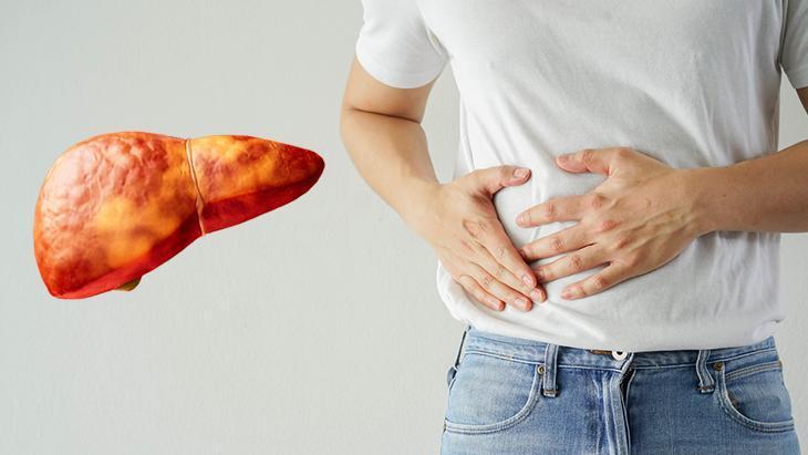 KARACİĞERİ YAĞLANDIRAN 5 ÖNEMLİ HATA