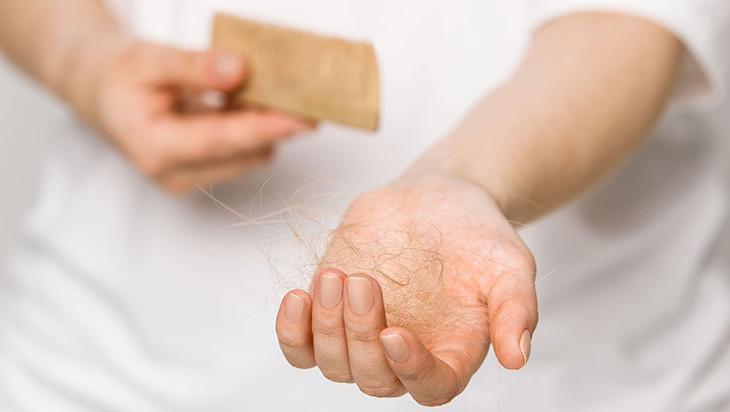 Saç dökülmesi işte deyip geçmeyin Nedenleri bambaşka, çözümü basit