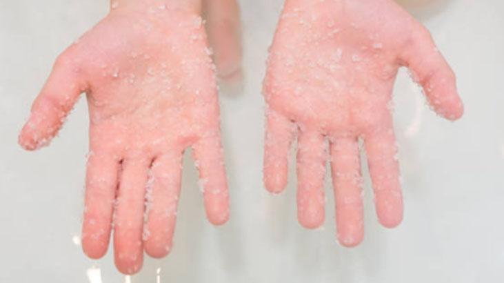 Soğuktan çatlarsa çaresi zeytinyağı-şekerde Pamuğa dönecek, doğal peeling