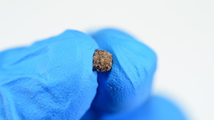 4-Meyve, sebze ve lifli gıdalar tüketin