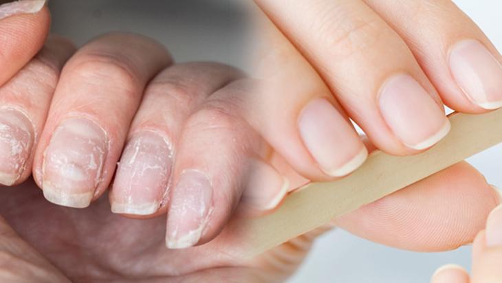 Elleri pamuk gibi yapıyor Soğuktan çatladıysa hemen sürün, birebir etki