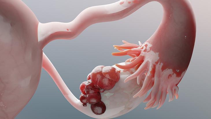 Üreme döneminde görülüyor