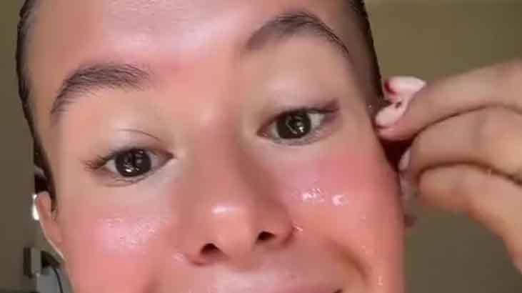 50 liraya doğal kapatıcı 2 malzeme yetiyor, şişliğe de morluğa da çare