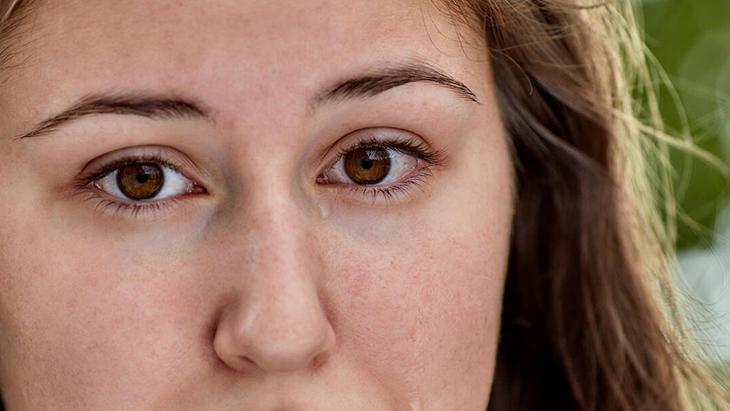 Ağlamaktan şişen gözler anında sönecek İyi hissettiren kafein devrede