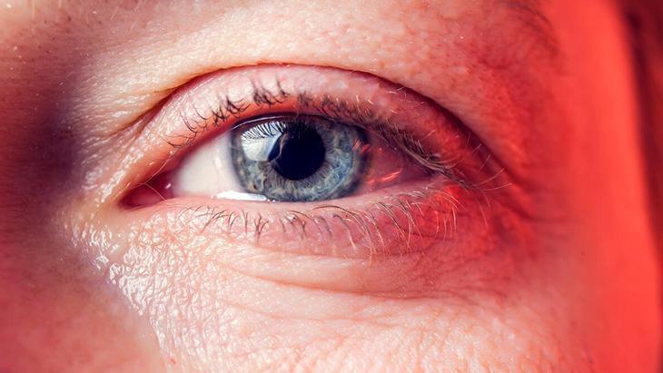 Ağlamaktan şişen gözler anında sönecek İyi hissettiren kafein devrede