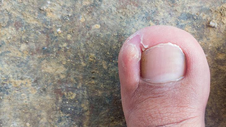 Tedavide hangi yöntemleri kullanılır