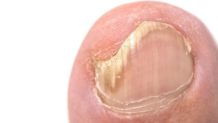 Profesyonel destek sorunu çözer