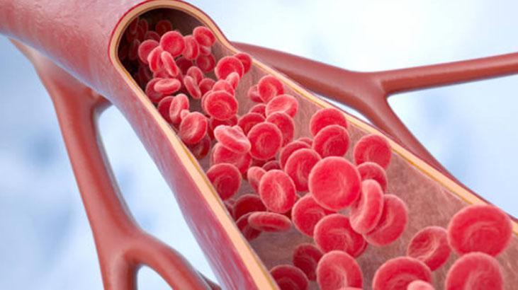 Aort damarı yırtılması nasıl tedavi edilir