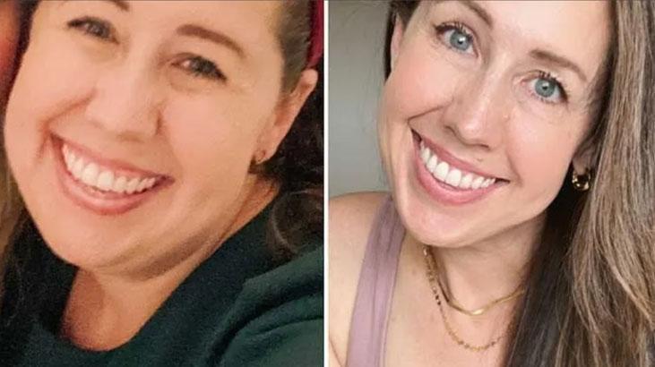 Altın değerinde 3 yiyeceği tüketti, 34 kilo verdi Aç kalmadan zayıflatıyor