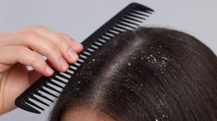 Saçta da bahar temizliği şart Yüzde 90 işe yarıyor, kepek eriyip gidiyor Saçta da bahar temizliği şart Yüzde 90 işe yarıyor, kepek eriyip gidiyor