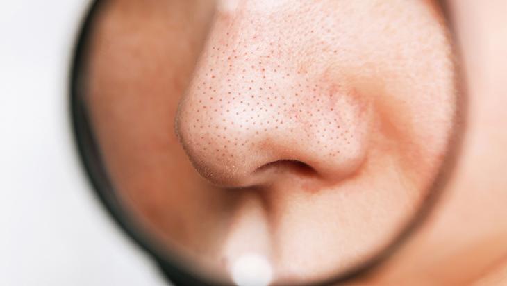 Siyah noktadan eser bırakmıyor 1 kez uygulayın, pürüzsüz çıkıyor Siyah noktadan eser bırakmıyor 1 kez uygulayın, pürüzsüz çıkıyor