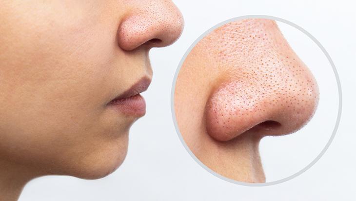 Siyah noktadan eser bırakmıyor 1 kez uygulayın, pürüzsüz çıkıyor Siyah noktadan eser bırakmıyor 1 kez uygulayın, pürüzsüz çıkıyor