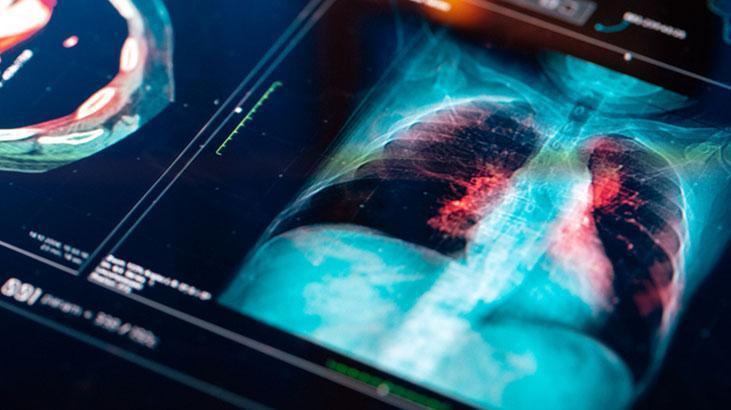 Yemek buharı - Mutfak Yemek buharı - Mutfak