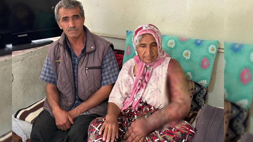 Her şey 8 yıl önce başladı Kolu şişti, vücuduna kadar yayıldı
