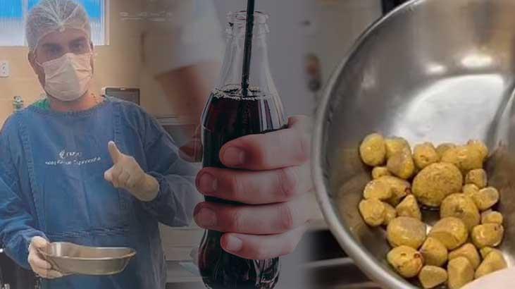 Obezite haberleri - son dakika obezite haber güncel gelişmeler