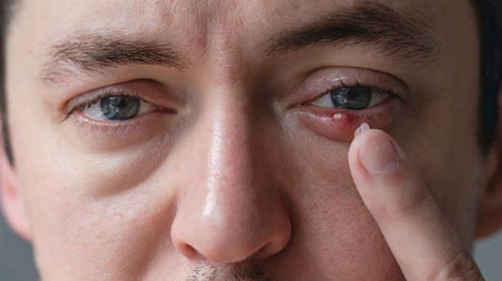 Maskülen görünmek için kirpikleri kesmeyin Hızla trend oldu: Kalıcı hasar bırakıyor Maskülen görünmek için kirpikleri kesmeyin Hızla trend oldu: Kalıcı hasar bırakıyor