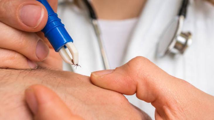 KENEYE NASIL MÜDAHALE EDİLİR