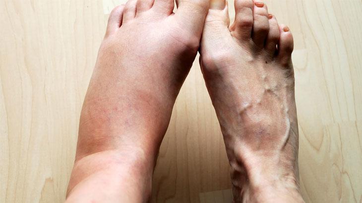 Hastalar nelere dikkat etmeli