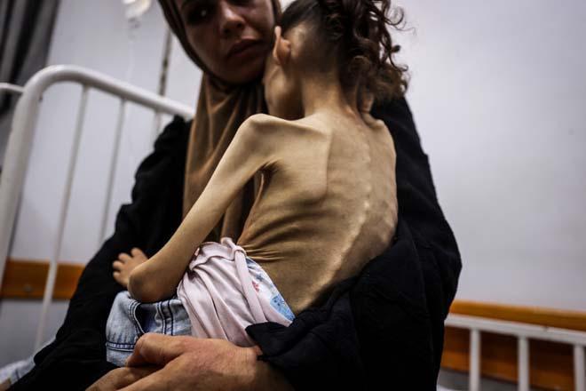 Gazzede Meryemin dramı: Fotoğraflar arasında sadece iki gün var