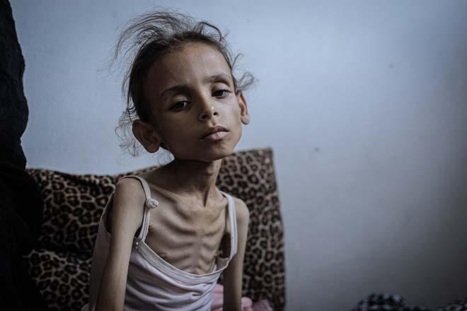 Gazzede Meryemin dramı: Fotoğraflar arasında sadece iki gün var