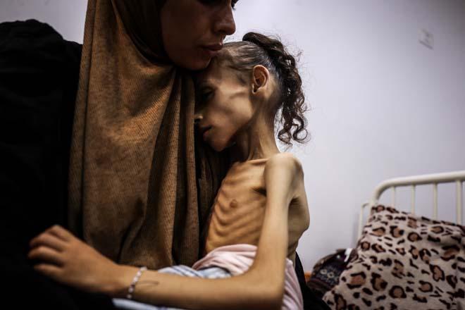 Gazzede Meryemin dramı: Fotoğraflar arasında sadece iki gün var