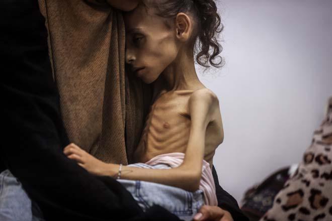 Gazzede Meryemin dramı: Fotoğraflar arasında sadece iki gün var