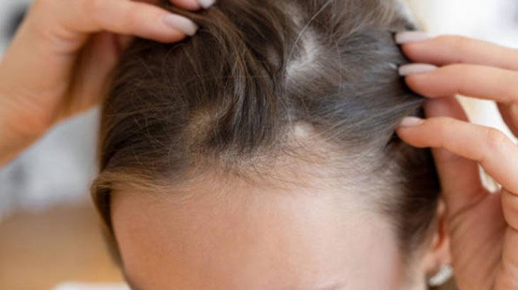 Pirelerin kökünü kazıyan hızlı yöntem Keskin kokusu sayesinde bir tanesi bile kalmayacak