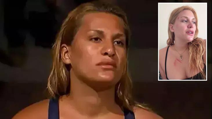 Survivor Almeda Baylan ölümden dönmüştü! Aracın geldiği hali paylaştı