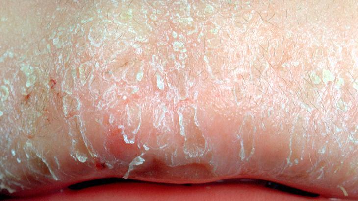 Saniyeler içinde pürüzsüz dudak görünümü Yağların nasıl kullanılacağını öğrenin