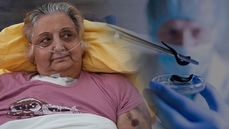 Yanlış sülük tedavisi canından ediyordu! Boynuna yapıştırdı, tüm vücudu zehirlendi