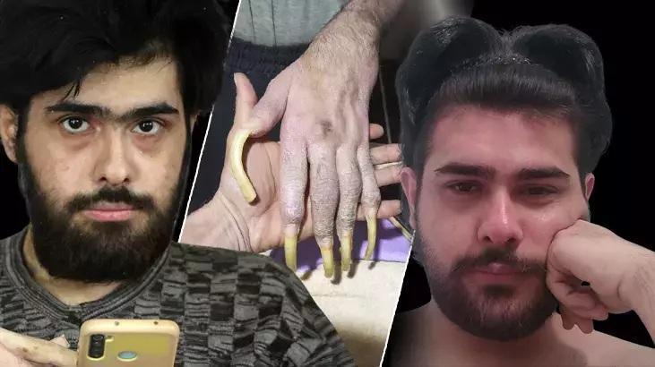 3 yıl sonra evden çıkan Barış için yeni adım! Sosyal hayata dönüş yolu açılıyor