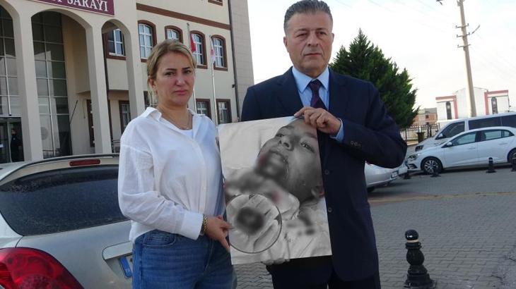 Okulda korkunç olay! 7 yaşındaki Kuzey Yiğit'in demir saplanan çenesi koptu