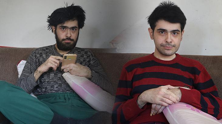Ne duş alıyor ne tırnaklarını kesiyordu! 3 yıl sonra evden çıkan Barış'a teşhis kondu
