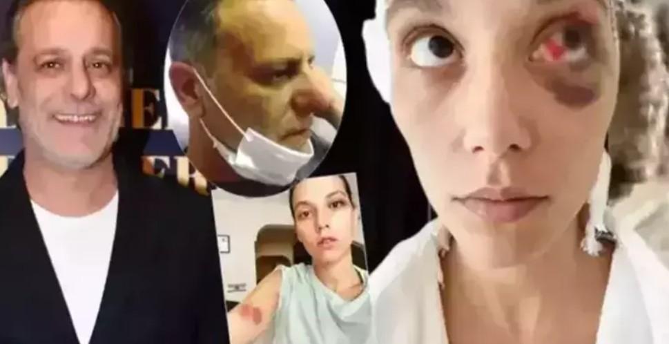 Ozan Güven 5 yıllık sessizliğini bozdu Eski sevgilisinden gönderme gecikmedi