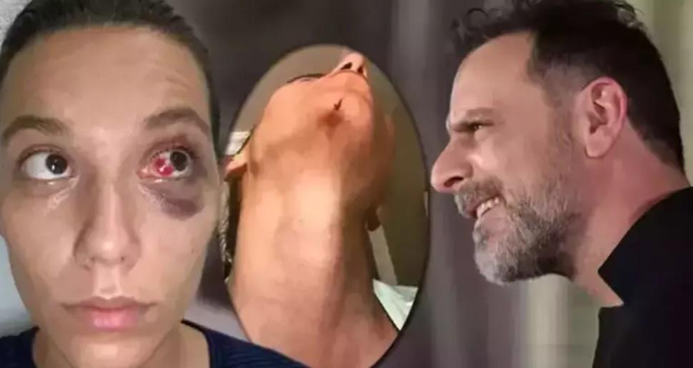 Ozan Güven 5 yıllık sessizliğini bozdu Eski sevgilisinden gönderme gecikmedi